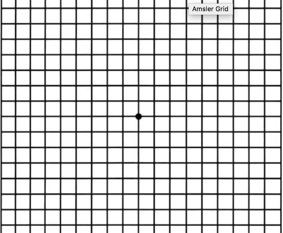  What Is An Amsler Grid Texas Retina Associates